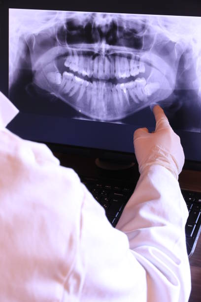 Best Emergency Tooth Extraction in Gretna, NE